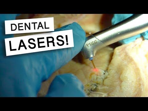 Our Brand New Waterlase Dental Laser!