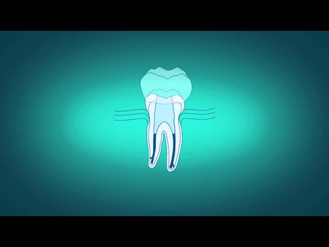Endodontic Group - Spring Hill, QLD