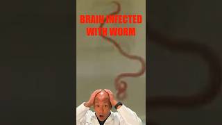 Surgeon Finds Worm in Brain: Parasite Invasion