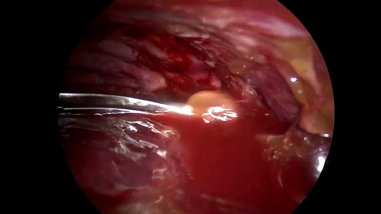 Fernando Espinoza Mercado-30