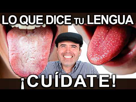 YOUR TONGUE REVEALS IF YOU HAVE THESE 4 DISEASES (CHECK THE COLOR NOW)