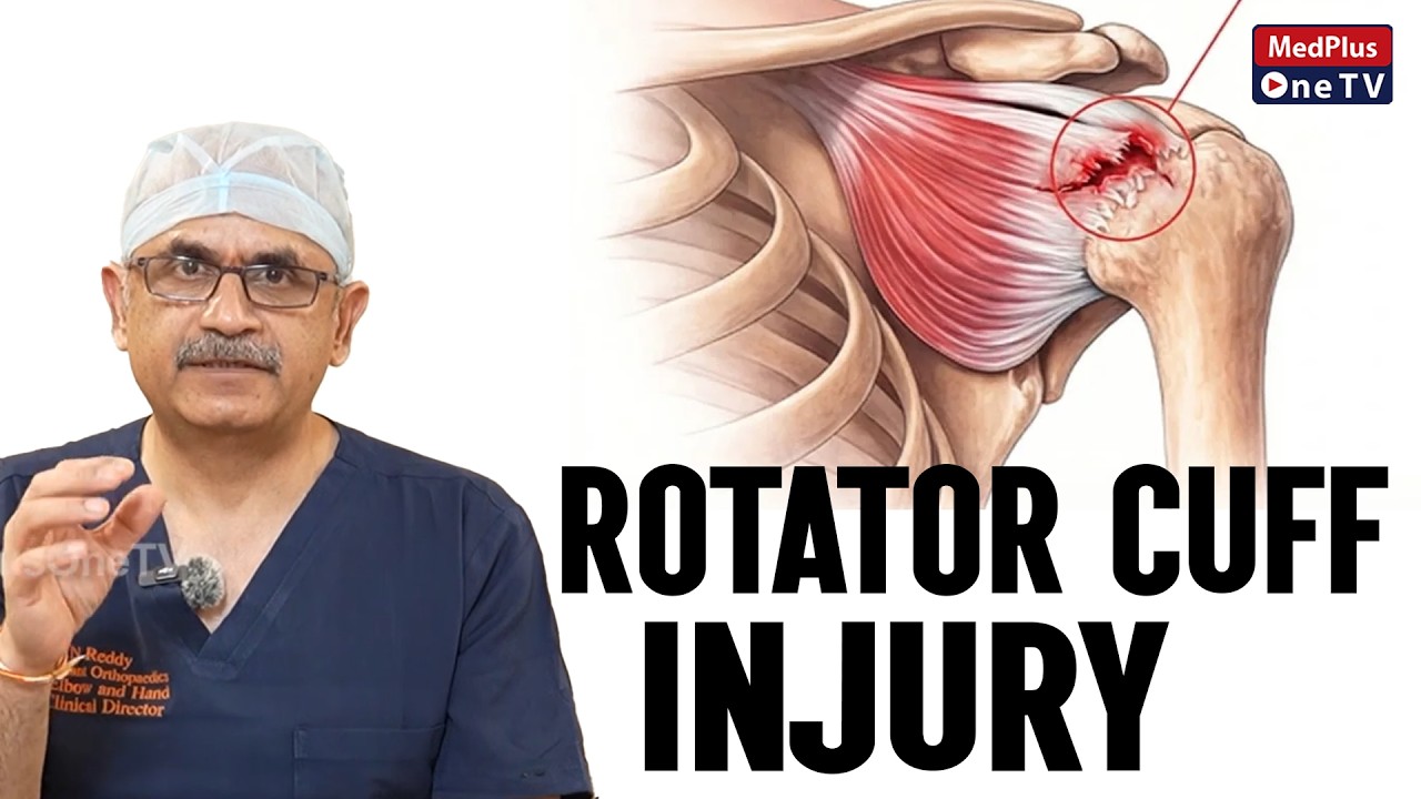 Understanding Rotator Cuff Injuries
