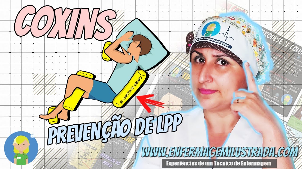 COXIM ou COXINS: Prevenção de LESÃO por PRESSÃO