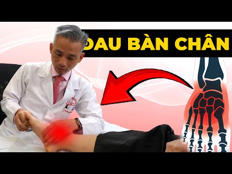 Đau Nhói Bàn Chân Buổi Sáng Không Thể Đi Được? Bác Sĩ Chỉ Cách Xử Trí