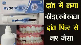 Hydent Duo Dual Defence Toothpaste | दांत में लगा कीड़ा, खोखला दांत फिर से नए जैसा |Tooth Cavity