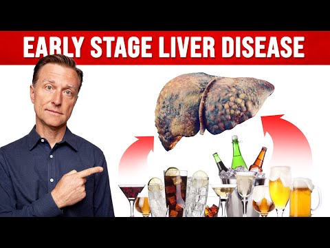 How Much Alcohol Would You Have to Drink Before Liver Damage