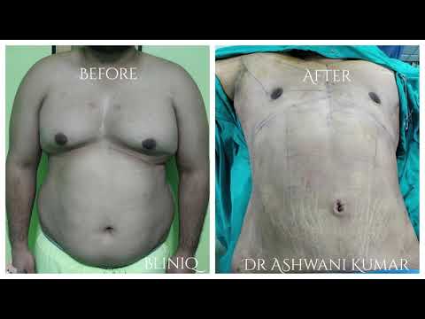 Patient Recovery Case — Video 14 (Clinical Testimonial)