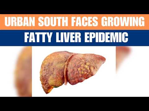 Urbean South's Fatty Liver Crisis | What's Behind Fatty Liver Epidemic | News9