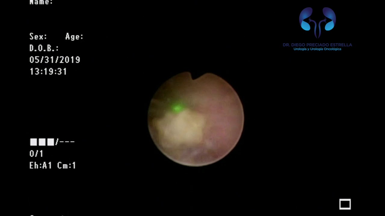 Diego Preciado Estrella-14