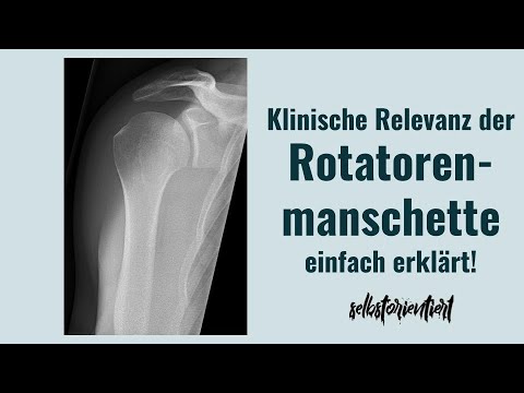 Rotatorenmanschettenruptur | Impingement-Syndrom | Luxationen des Schultergelenks einfach erklärt!