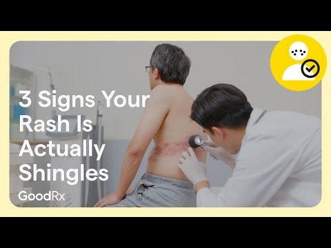 3 Signs Your Rash Is Actually Shingles | GoodRx