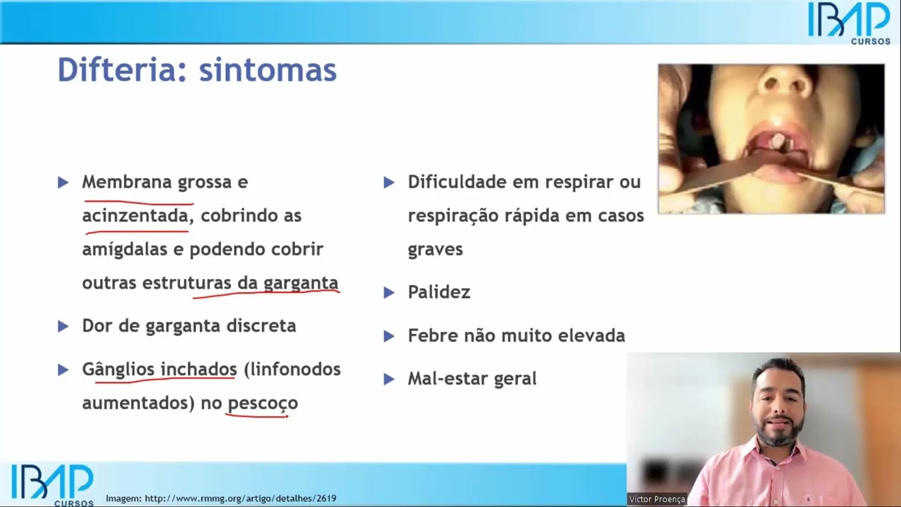 Difteria: o que é, causas, sintomas e tratamento | Corynebacterium diphtheriae | Dr. Victor Proença
