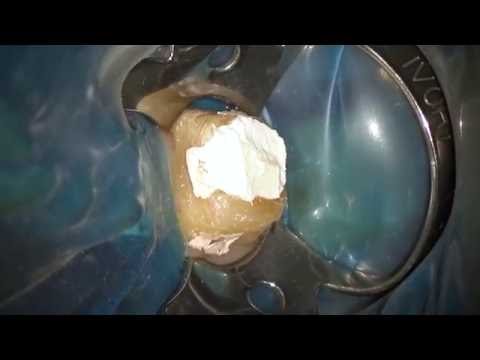download lagu mp3 mp4 Root Canal Microscope, download lagu Root Canal Microscope gratis, unduh video klip Root Canal Microscope