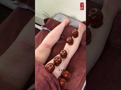Lighten Up Leg Cups: The Qilin Jar Technique Unveiled
