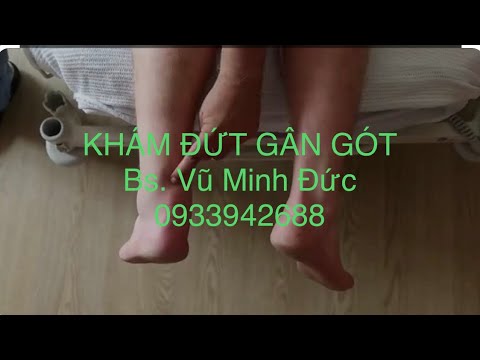 CHẨN ĐOÁN ĐỨT GÂN GÓT BẰNG TEST THOMPSON