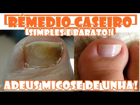 Siccome la moglie fa del marito dellalcolizzato Video su dipendenza alcolica