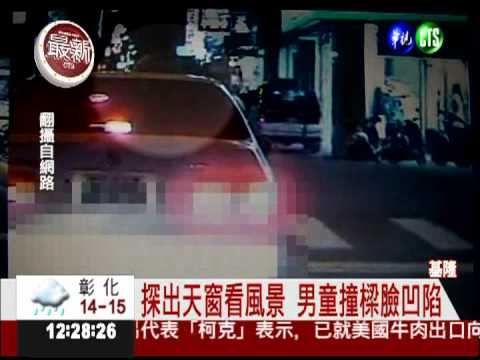 探出天窗看風景 男童撞樑柱毀容