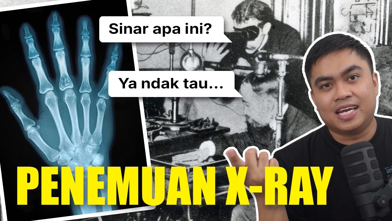 Bahkan penemunya tidak tahu apa yang dia temukan... Kisah Penemuan X-Ray.