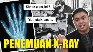 Download lagu Bahkan penemunya tidak tahu apa yang dia temukan... Kisah Penemuan X-Ray. mp3