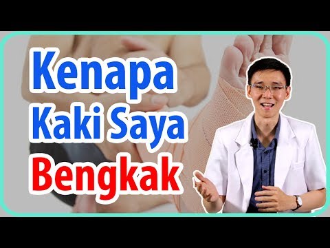 Kenapa Kaki Saya Bengkak