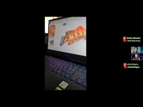 Escáner y escaneo intraoral 3D