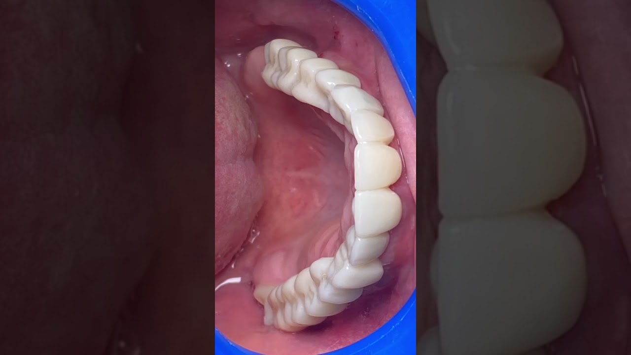 Enrique Sanroman Fitch-4