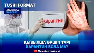 Қызылшаға қарсы екпе алмаған балалар ауруханаға жатқызылмайды