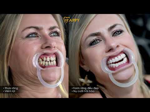 Foreign customers' feedback about Happy Smile Dental