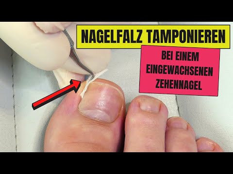 Sellerie Rezept für Gelenke Pjatigorsk Behandlung von Gelenk Preis