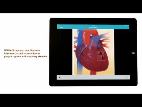 CardioVisual video/presentation/materials
