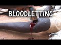 Modern Day Blood-letting in North Africa