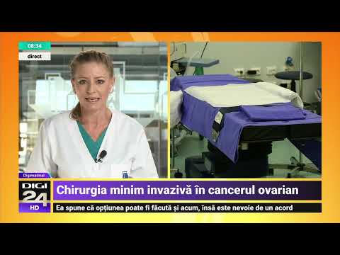 Cancerul ovarian - Dr. Eliza Gangone | Spitalul Clinic SANADOR
