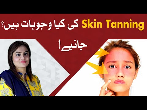 What is Skin tanning ? | Skin Tanning kyun hoti hai?