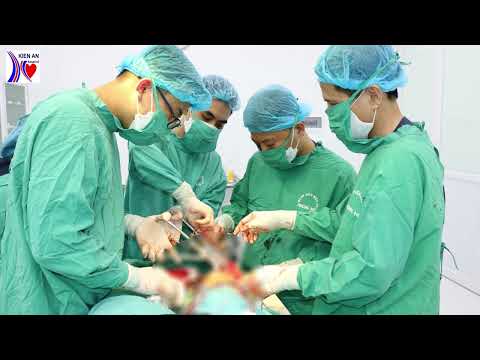 Bệnh viện Kiến An phẫu thuật thành công ca kết hợp xương gãy 2 mâm chày