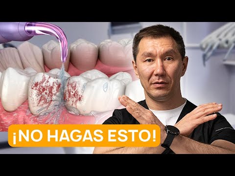 Miniatura del vídeo: cómo elegir irrigador dental portátil en Cyber Monday