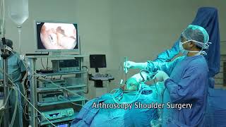 Arthroscopy Rotator Cuff Surgery
