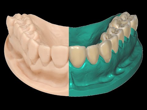 Как преобразовать скан челюсти в модель для 3D печати?