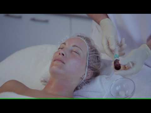 Fusion Fractional Meso - Face