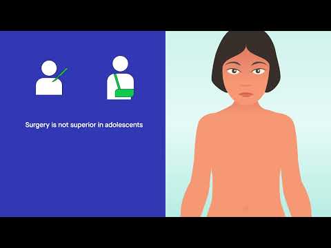 Completely displaced midshaft clavicle fractures in adolescents