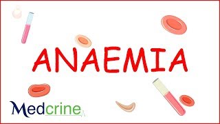 Anemia : causes, classification, clinical features, treatment