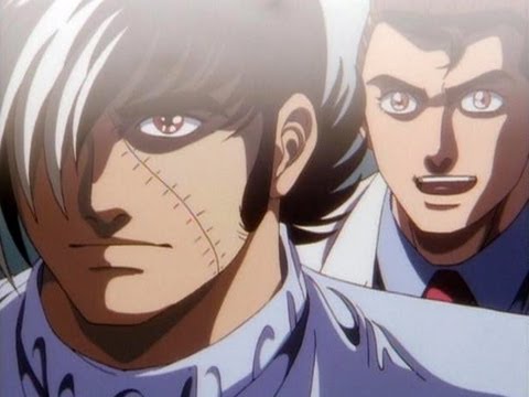 ブラック・ジャック  (1993年 OVA) Video7