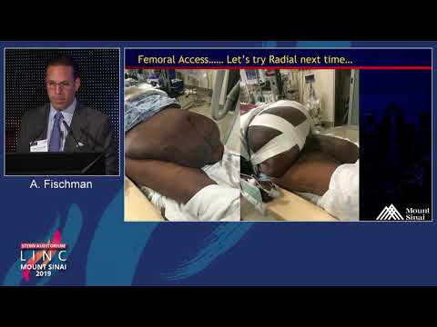 Stern D2 - Radial Access for SFA Intervention: How Do I incorporate into my Practice? - Dr. Fischman
