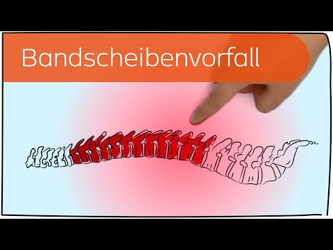 Was mit der Luxation des Schultergelenks zu tun Neck Chondrose das Kind Behandlung