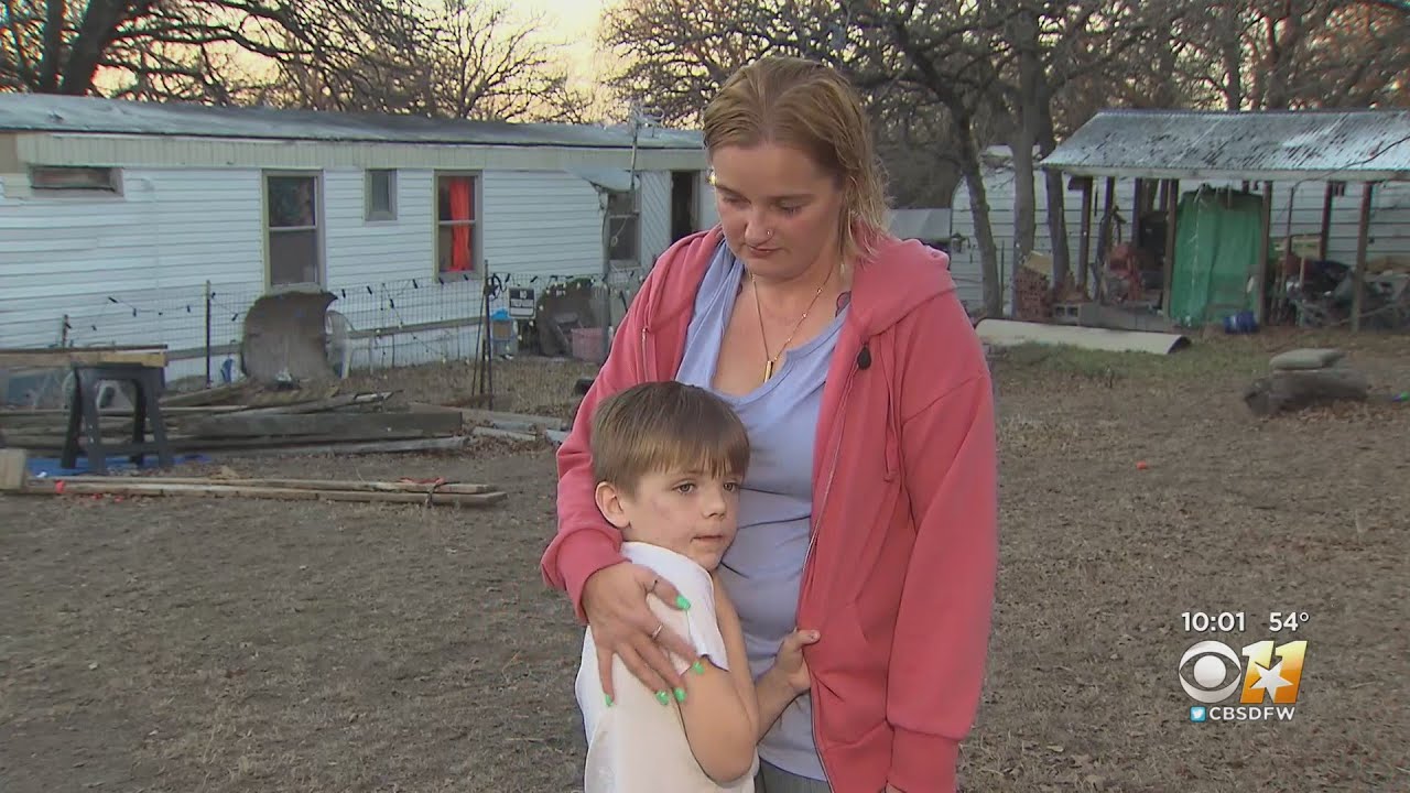 7-Year-Old Recovering From Vicious Dog Attack After Neighbor Chases Animal Down The Street 