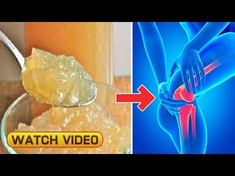 Arthrose von 2 Grad des Kniegelenks zu behandelnden Wie der Knorpel im Kniegelenk zu erhöhen