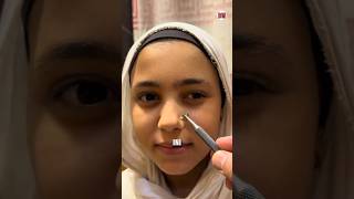 Download lagu bee sting therapy mp3