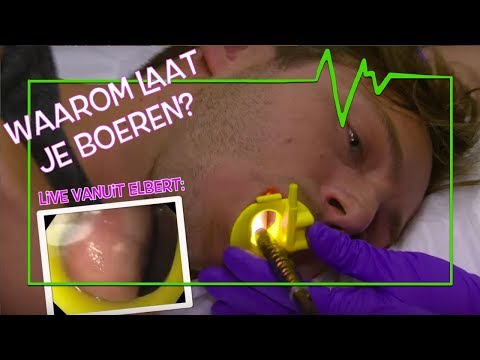 WAAROM LATEN WE BOEREN!? - TOPDOKS ONDERZOEK