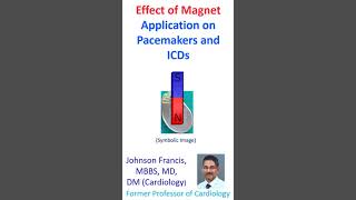 Effect of magnet application on pacemakers and ICDs
