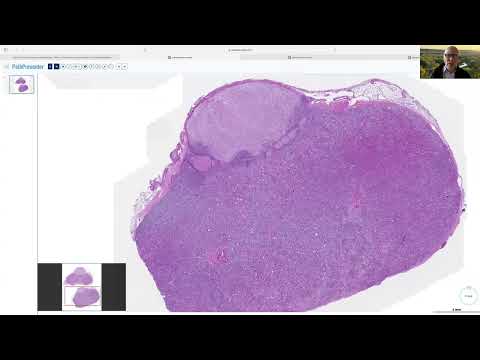 AANP Teaching Rounds - February 26, 2025 - PitNET/Pituitary Adenoma Classification: Survival Tips