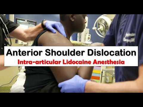 Anterior shoulder dislocation and anesthesia with intra-arti...